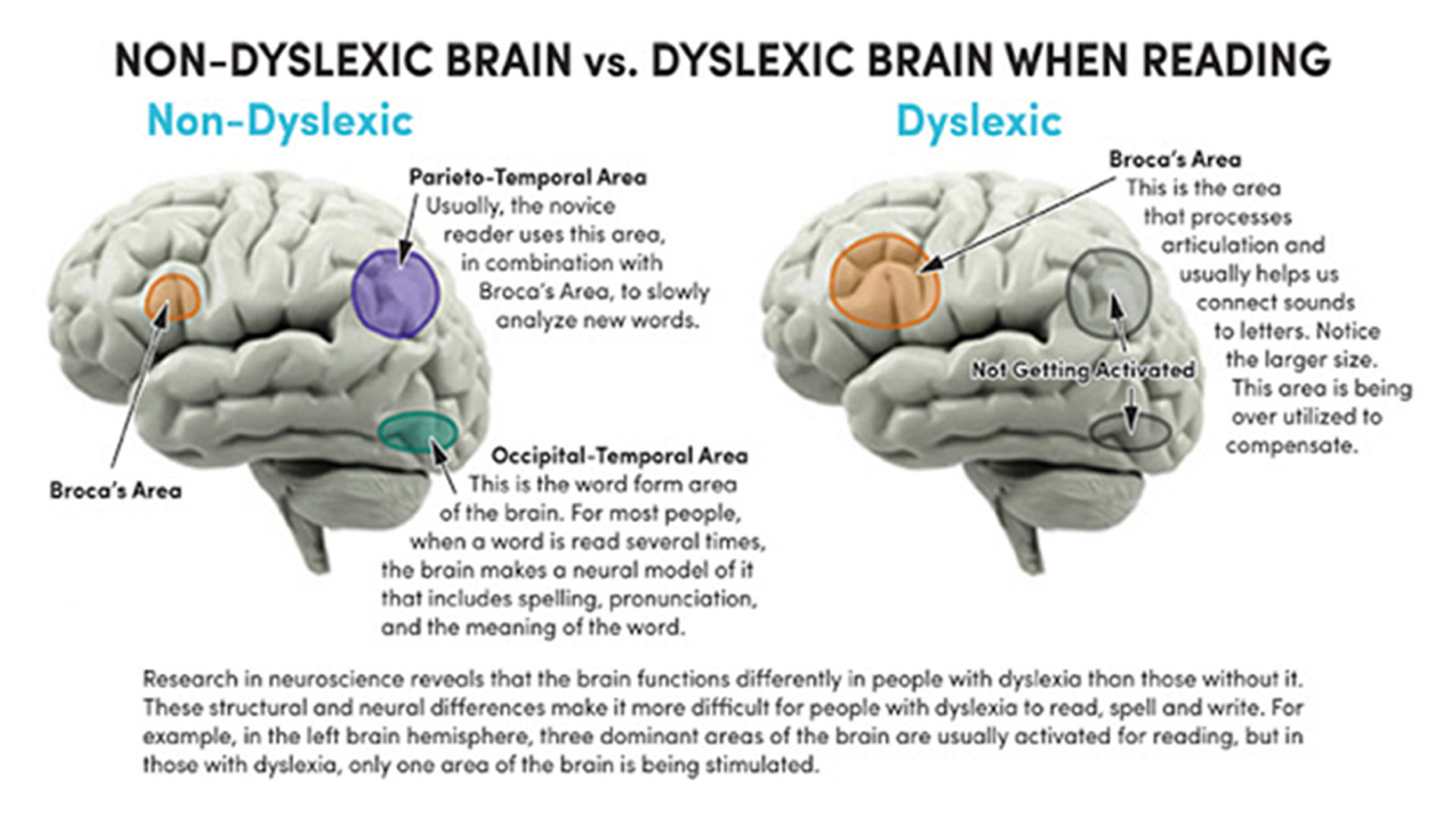 Understanding Dyslexia Cognitive Development Learning Centre